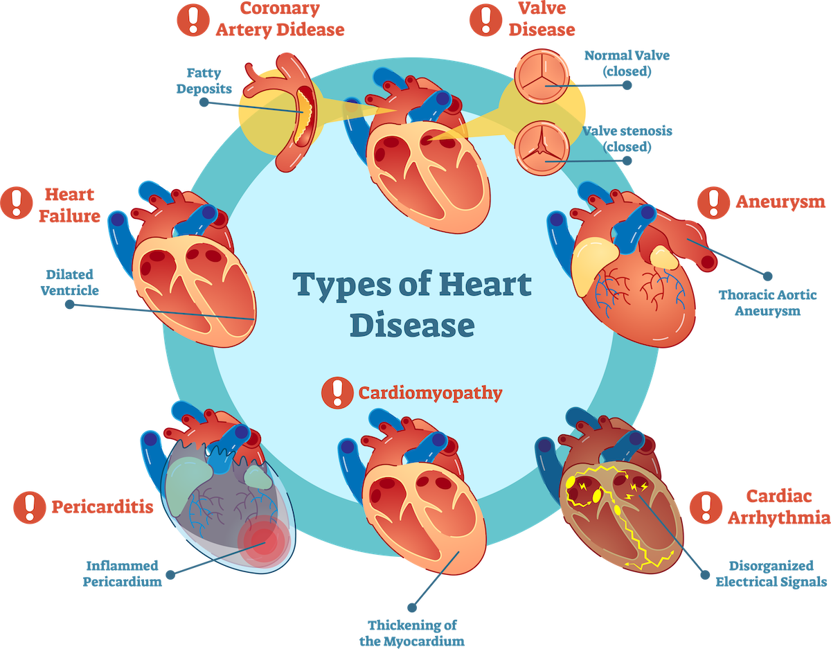 Understanding+heart+disease+as+a++pervasive+threat+to+Black+Women%E2%80%99s+Health